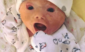 Mom shocked by her baby after birth, her words now spread like forest fire!