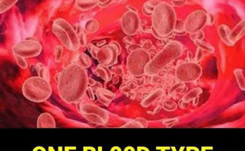 The Role of Infection & Lifestyle